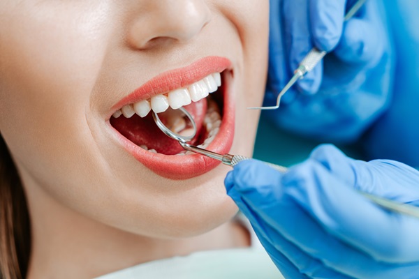 Signs Of A Worn Dental Filling