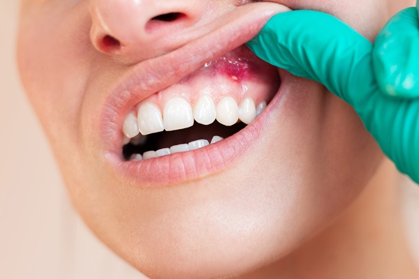 Can Gum Disease Be Treated At Home?